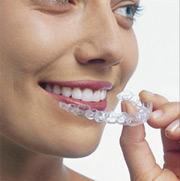 applicazione Invisalign